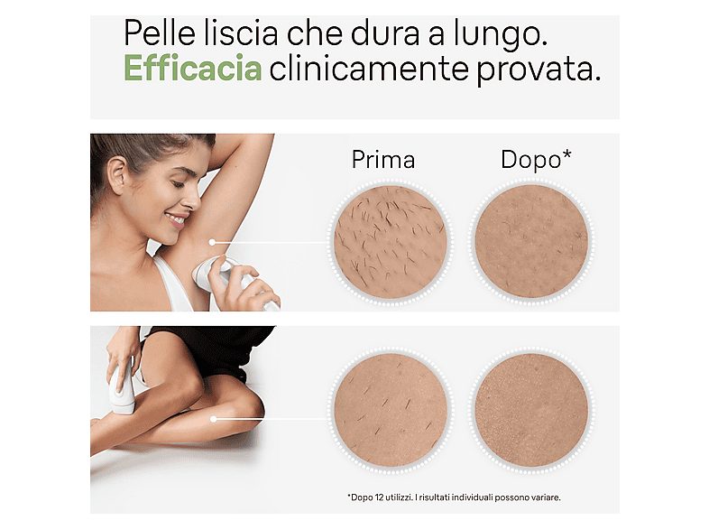 1:depiladora-ipl-braun-7500435238267-adherible-al-cuerpo-accesorio-de-precision-para-rostro-accesorio-de-precision-para-rostro-blanco-1.jpg|2:depiladora-ipl-braun-7500435238267-adherible-al-cuerpo-accesorio-de-precision-para-rostro-accesorio-de-precision-