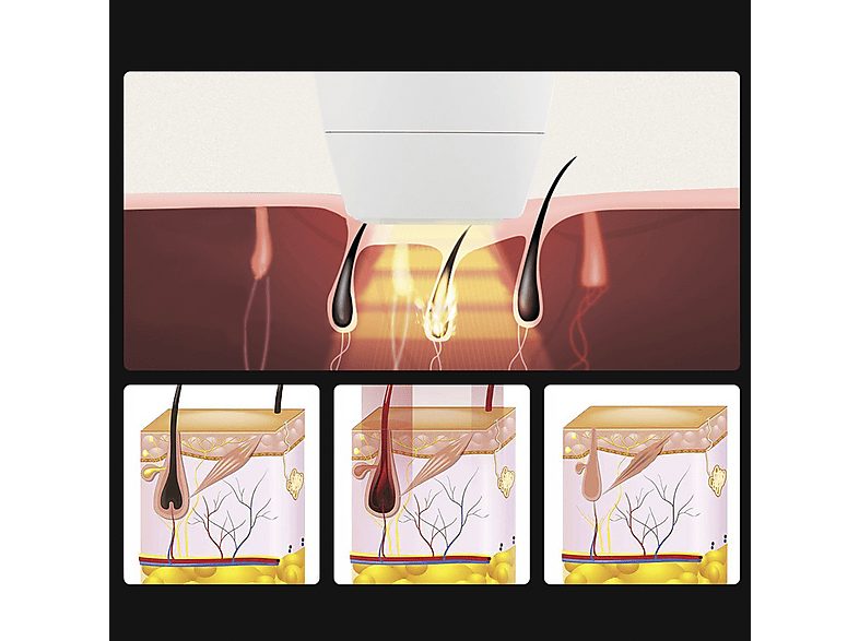 1:depiladora-ipl-idermia-tm-005-con-luz-de-color-tubo-de-lampara-de-cuarzo-blanco-1.jpg|2:depiladora-ipl-idermia-tm-005-con-luz-de-color-tubo-de-lampara-de-cuarzo-blanco-2.jpg|3:depiladora-ipl-idermia-tm-005-con-luz-de-color-tubo-de-lampara-de-cuarzo-blan