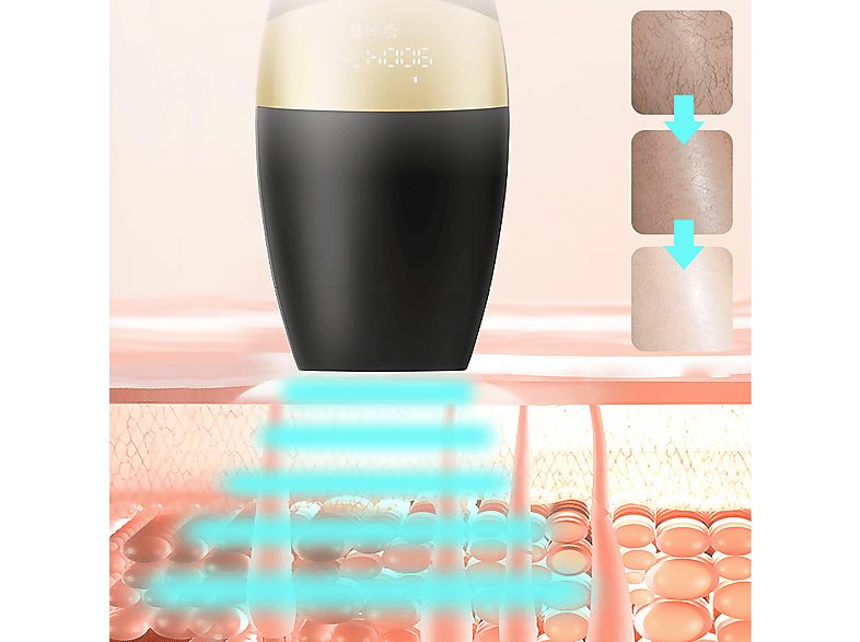 1:depiladora-ipl-idermia-tm-005-con-luz-de-color-tubo-de-lampara-de-cuarzo-negro-1.jpg|2:depiladora-ipl-idermia-tm-005-con-luz-de-color-tubo-de-lampara-de-cuarzo-negro-2.jpg|3:depiladora-ipl-idermia-tm-005-con-luz-de-color-tubo-de-lampara-de-cuarzo-negro-