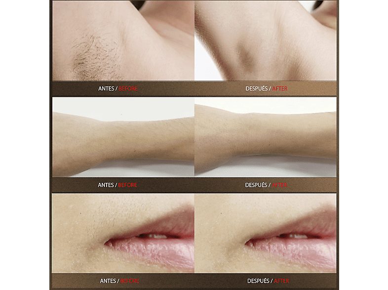 1:depiladora-ipl-idermia-tm-1127-360-sensacion-de-hielo-envolvente-5-niveles-de-ajuste-de-potencia-verde-1.jpg|2:depiladora-ipl-idermia-tm-1127-360-sensacion-de-hielo-envolvente-5-niveles-de-ajuste-de-potencia-verde-2.jpg|3:depiladora-ipl-idermia-tm-1127-