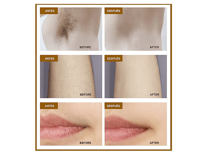 1:depiladora-ipl-idermia-ts8-de-luz-pulsada-2-modos-de-uso-dispone-de-pantalla-digital-led-blanco-1.jpg|2:depiladora-ipl-idermia-ts8-de-luz-pulsada-2-modos-de-uso-dispone-de-pantalla-digital-led-blanco-2.jpg|3:depiladora-ipl-idermia-ts8-de-luz-pulsada-2-m
