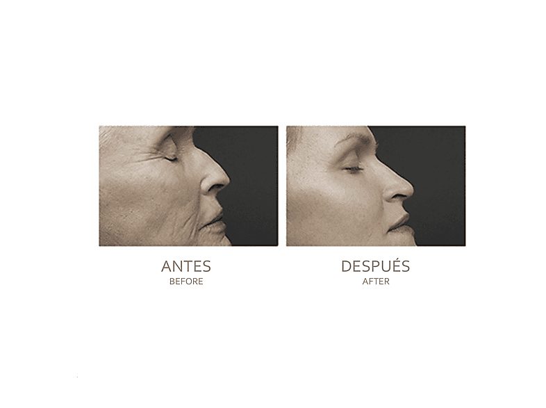 1:masajeador-facial-idermia-dmar0083c00-cara-negro-1.jpg|2:masajeador-facial-idermia-dmar0083c00-cara-negro-2.jpg|3:masajeador-facial-idermia-dmar0083c00-cara-negro-3.jpg|4:masajeador-facial-idermia-dmar0083c00-cara-negro-4.jpg|5:masajeador-facial-idermia