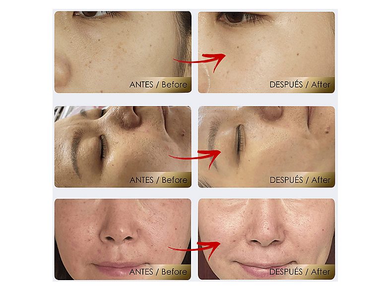 1:rejuvenecedor-facial-dam-electronics-dmav0056-cara-blanco-1.jpg|2:rejuvenecedor-facial-dam-electronics-dmav0056-cara-blanco-2.jpg|3:rejuvenecedor-facial-dam-electronics-dmav0056-cara-blanco-3.jpg|4:rejuvenecedor-facial-dam-electronics-dmav0056-cara-blan