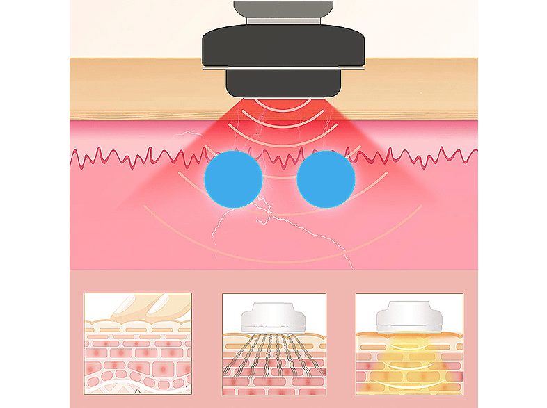 1:rejuvenecedor-facial-idermia-dman0059c00-cara-piernas-negro-1.jpg|2:rejuvenecedor-facial-idermia-dman0059c00-cara-piernas-negro-2.jpg|3:rejuvenecedor-facial-idermia-dman0059c00-cara-piernas-negro-3.jpg|4:rejuvenecedor-facial-idermia-dman0059c00-cara-pie