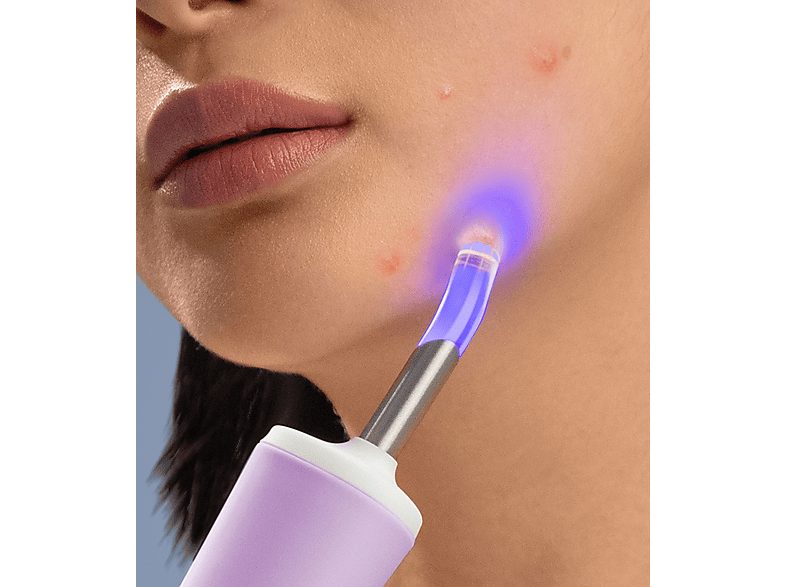 1:tratamiento-antiacne-foreo-espada-2-plus-apagado-automatico-lavanda-1.jpg|2:tratamiento-antiacne-foreo-espada-2-plus-apagado-automatico-lavanda-2.jpg|3:tratamiento-antiacne-foreo-espada-2-plus-apagado-automatico-lavanda-3.jpg|4:tratamiento-antiacne-fore